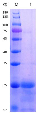 12% SDS-PAGE analysis profiles of purified NTHI1101-20-193 (CBB stained).